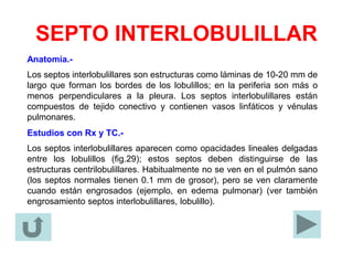 SEPTO INTERLOBULILLAR
Anatomía.-
Los septos interlobulillares son estructuras como láminas de 10-20 mm de
largo que forman los bordes de los lobulillos; en la periferia son más o
menos perpendiculares a la pleura. Los septos interlobulillares están
compuestos de tejido conectivo y contienen vasos linfáticos y vénulas
pulmonares.
Estudios con Rx y TC.-
Los septos interlobulillares aparecen como opacidades lineales delgadas
entre los lobulillos (fig.29); estos septos deben distinguirse de las
estructuras centrilobulillares. Habitualmente no se ven en el pulmón sano
(los septos normales tienen 0.1 mm de grosor), pero se ven claramente
cuando están engrosados (ejemplo, en edema pulmonar) (ver también
engrosamiento septos interlobulillares, lobulillo).
 