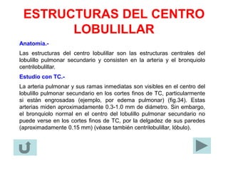 ESTRUCTURAS DEL CENTRO
LOBULILLAR
Anatomía.-
Las estructuras del centro lobulillar son las estructuras centrales del
lobulillo pulmonar secundario y consisten en la arteria y el bronquiolo
centrilobulillar.
Estudio con TC.-
La arteria pulmonar y sus ramas inmediatas son visibles en el centro del
lobulillo pulmonar secundario en los cortes finos de TC, particularmente
si están engrosadas (ejemplo, por edema pulmonar) (fig.34). Estas
arterias miden aproximadamente 0.3-1.0 mm de diámetro. Sin embargo,
el bronquiolo normal en el centro del lobulillo pulmonar secundario no
puede verse en los cortes finos de TC, por la delgadez de sus paredes
(aproximadamente 0.15 mm) (véase también centrilobulillar, lóbulo).
 