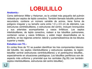 LOBULILLO
Anatomía.-
Como definieron Miller y Heitzman, es la unidad más pequeña del pulmón
rodeada por septos de tejido conectivo. También llamado lobulillo pulmonar
secundario, contiene un número variable de acinos, tiene forma de
polígono irregular y su tamaño varía entre 1.0 y 2.5 cm de diámetro. Las
estructuras centrilobulillares, o estructuras del centro, incluyen bronquiolos
y sus arteriolas acompañantes y vasos linfáticos. Los septos
interlobulillares, de tejido conectivo, rodean a los lobulillos pulmonares,
contienen venas y vasos linfáticos, y están mejor desarrollados en la
periferia, en las regiones anterior, lateral y yuxtamediastínica de los lóbulos
superior y medio.
Estudios con TC.-
En cortes finos de TC se pueden identificar los tres componentes básicos
del lobulillo, los septos interlobulillares y estructuras septales, la región
lobulillar central (estructuras centrilobulillares) y el parénquima lobulillar,,
especialmente en situaciones patológicas. Los lobulillos periféricos son de
aspecto más uniforme y piramidal que los centrales (fig.35) (ver también
septos interlobulillares, estructuras del centro lobulillar).
 
