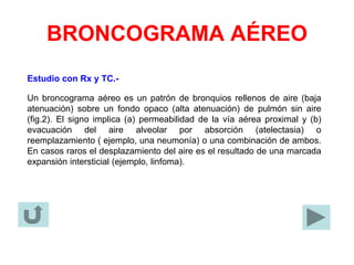 BRONCOGRAMA AÉREO
Estudio con Rx y TC.-
Un broncograma aéreo es un patrón de bronquios rellenos de aire (baja
atenuación) sobre un fondo opaco (alta atenuación) de pulmón sin aire
(fig.2). El signo implica (a) permeabilidad de la vía aérea proximal y (b)
evacuación del aire alveolar por absorción (atelectasia) o
reemplazamiento ( ejemplo, una neumonía) o una combinación de ambos.
En casos raros el desplazamiento del aire es el resultado de una marcada
expansión intersticial (ejemplo, linfoma).
 