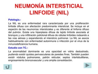 NEUMONÍA INTERSTICIAL
LINFOIDE (NIL)
Patología.-
La NIL es una enfermedad rara caracterizada por una proliferación
linfoide difusa con afectación predominante intersticial. Se incluye en el
espectro de las neumonías intersticiales y es diferente al linfoma difuso
del pulmón. Existe una hiperplasia difusa de tejido linfoide asociada al
bronquio y una infiltración policlonal difusa de células linfoides rodeando a
las vías aéreas y expandiendo el intersticio pulmonar. La NIL se asocia
habitualmente con enfermedad autoinmune o infección por el virus de la
inmunodeficiencia humana.
Estudio con TC.-
La anormalidad dominante es una opacidad en vidrio deslustrado,
pudiendo existir quistes perivasculares de paredes finas. También pueden
existir nódulos pulmonares, patrón reticular, septos interlobulillares,
engrosamiento broncovascular y una amplia consolidación.
 