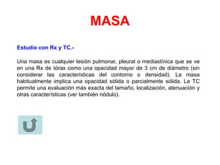 MASA
Estudio con Rx y TC.-
Una masa es cualquier lesión pulmonar, pleural o mediastínica que se ve
en una Rx de tórax como una opacidad mayor de 3 cm de diámetro (sin
considerar las características del contorno o densidad). La masa
habitualmente implica una opacidad sólida o parcialmente sólida. La TC
permite una evaluación más exacta del tamaño, localización, atenuación y
otras características (ver también nódulo).
 
