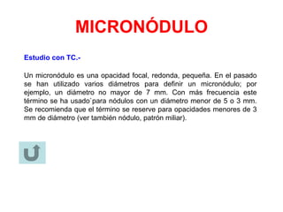 MICRONÓDULO
Estudio con TC.-
Un micronódulo es una opacidad focal, redonda, pequeña. En el pasado
se han utilizado varios diámetros para definir un micronódulo; por
ejemplo, un diámetro no mayor de 7 mm. Con más frecuencia este
término se ha usado`para nódulos con un diámetro menor de 5 o 3 mm.
Se recomienda que el término se reserve para opacidades menores de 3
mm de diámetro (ver también nódulo, patrón miliar).
 