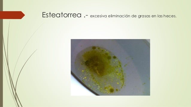 Glosario sistema digestivo 1