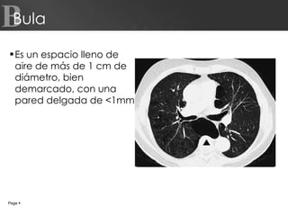 Bula Es un espacio lleno de aire de más de 1 cm de diámetro, bien demarcado, con una pared delgada de <1mm. Page     B 