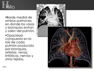 Borde medial de ambos pulmones, en donde los vasos y bronquios entran y salen del pulmón. Opacidad compuesta en la raíz de cada pulmón producida por bronquios, arterias, venas, linfáticos, nervios y otros tejidos. Hilio Page     H 