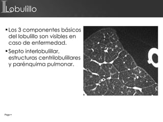 Lobulillo Los 3 componentes básicos del lobulillo son visibles en caso de enfermedad. Septo interlobulillar, estructuras centrilobulillares  y parénquima pulmonar. L Page     