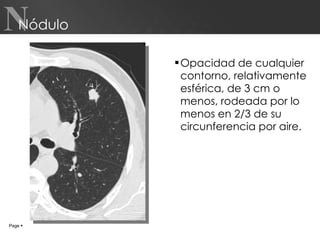 Nódulo Opacidad de cualquier contorno, relativamente esférica, de 3 cm o menos, rodeada por lo menos en 2/3 de su circunferencia por aire. Page     N 