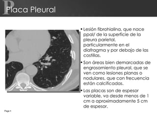 Placa Pleural Lesión fibrohialina, que nace ppal/ de la superficie de la pleura parietal, particularmente en el diafragma y por debajo de las costillas.  Son áreas bien demarcadas de engrosamiento pleural, que se ven como lesiones planas o nodulares, que con frecuencia están calcificadas.  Las placas son de espesor variable, va desde menos de 1 cm a aproximadamente 5 cm de espesor. Page     P 