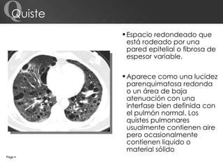 Espacio redondeado que está rodeado por una pared epitelial o fibrosa de espesor variable. Aparece como una lucidez parenquimatosa redonda o un área de baja atenuación con una interfase bien definida con el pulmón normal. Los quistes pulmonares usualmente contienen aire pero ocasionalmente contienen liquido o material sólido Quiste Page     Q 