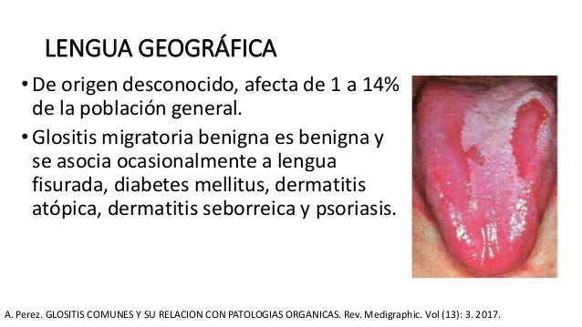 Glositis