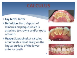  Lay term: Tartar
 Definition: Hard deposit of
mineralized plaque which is
attached to crowns and/or roots
of teeth.
 Usage: Supragingival calculus
accumulates most easily on the
lingual surface of the lower
anterior teeth.

CALCULUS
 