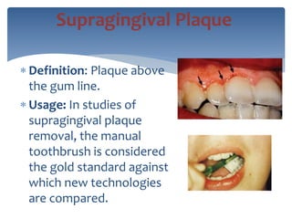  Definition: Plaque above
the gum line.
 Usage: In studies of
supragingival plaque
removal, the manual
toothbrush is considered
the gold standard against
which new technologies
are compared.
Supragingival Plaque
 