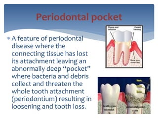 endo meaning dental endo meaning dental