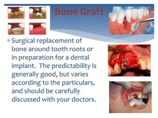  Surgical replacement of
bone around tooth roots or
in preparation for a dental
implant. The predictability is
generally good, but varies
according to the particulars,
and should be carefully
discussed with your doctors.
Bone Graft
 