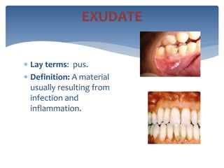  Lay terms: pus.
 Definition: A material
usually resulting from
infection and
inflammation.
EXUDATE
 