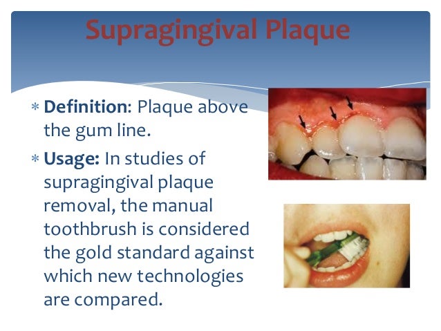 introduction to endodontics