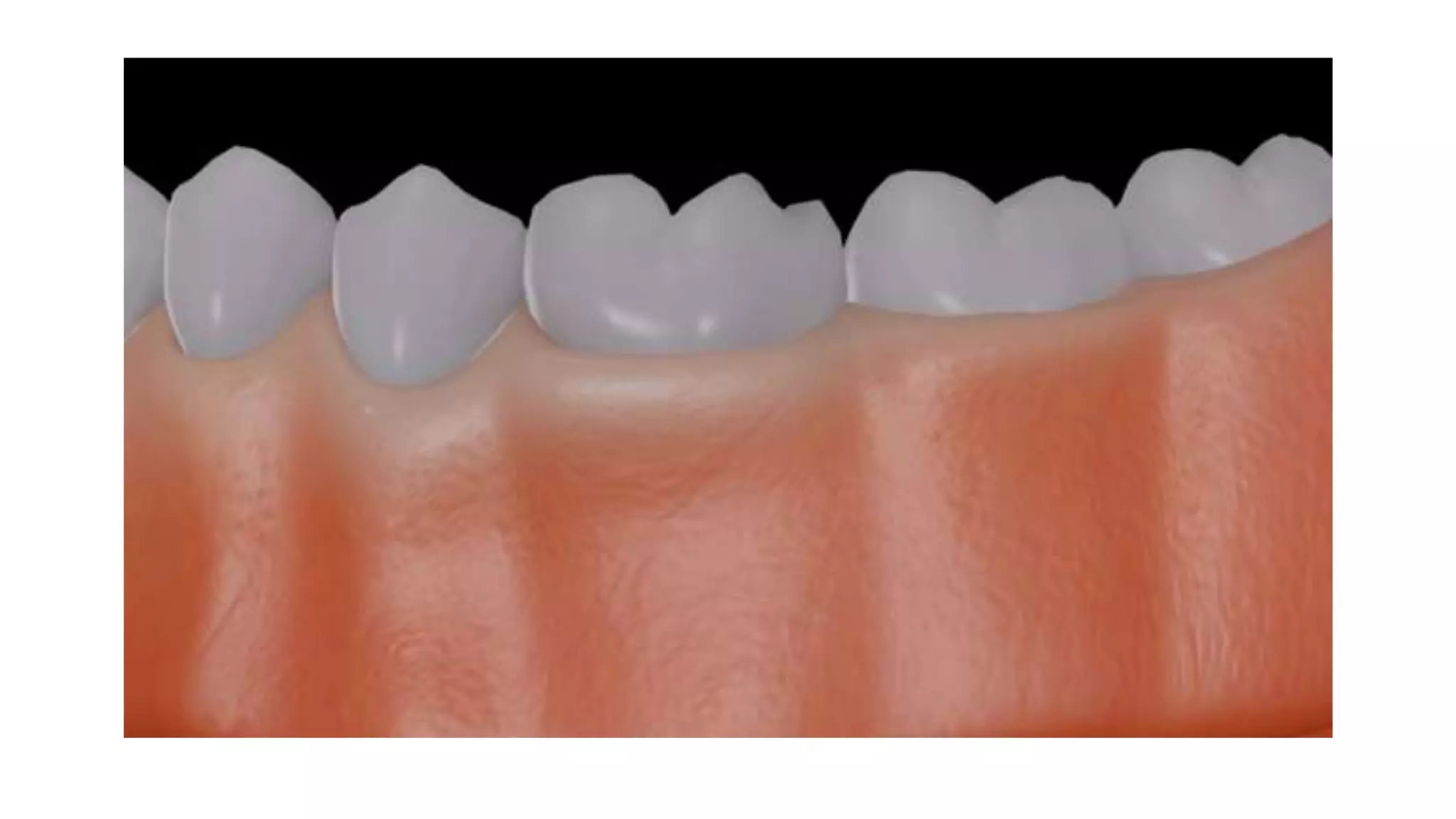 Glossary of Dental Terminology.pptx