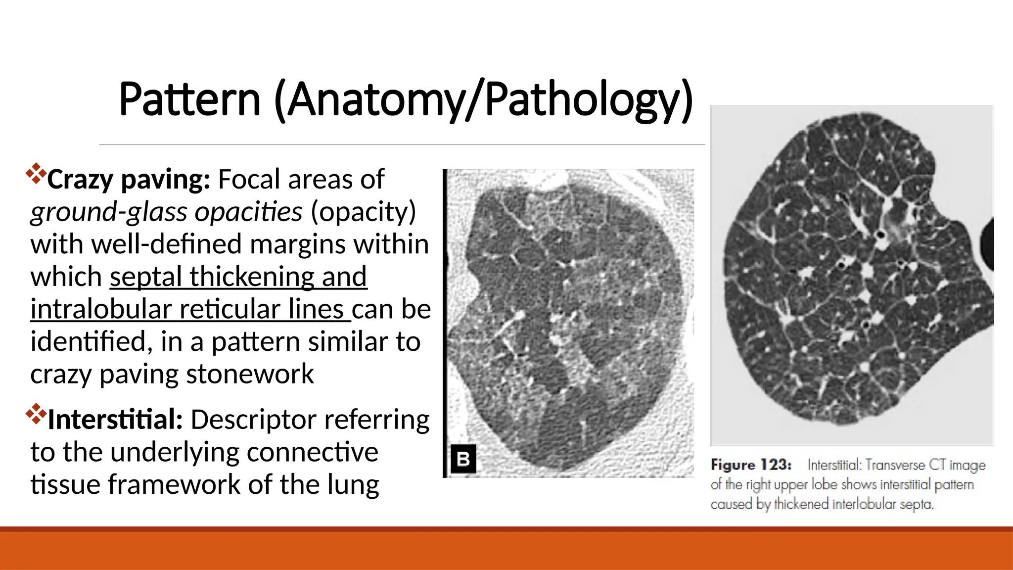 Glossary of terms in Thoracic Radiology: The Fleischner Society 2024 ...
