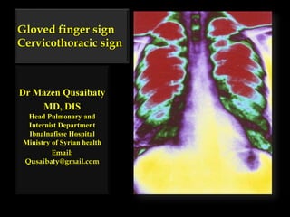 Gloved finger sign
Cervicothoracic sign
Dr Mazen Qusaibaty
MD, DIS
Head Pulmonary and
Internist Department
Ibnalnafisse Hospital
Ministry of Syrian health
Email:
Qusaibaty@gmail.com
 