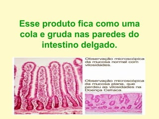 Esse produto fica como uma
cola e gruda nas paredes do
intestino delgado.
 