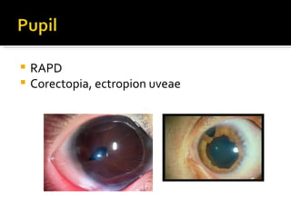 Corectopia Rabbit Gluacoma clinical evaluation | PPT