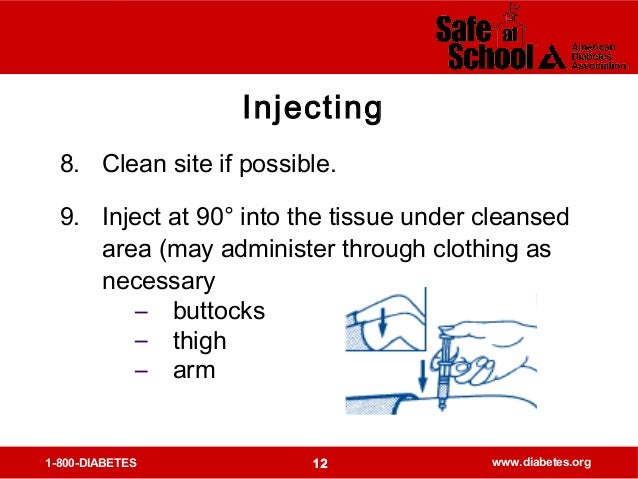Glucagon administration diagram of injection sites 