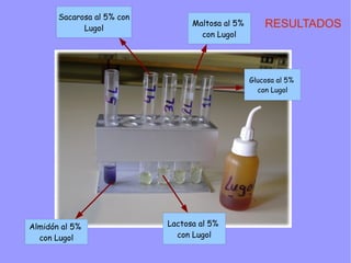 Sacarosa al 5% con
             Lugol
                                  Maltosa al 5%       RESULTADOS
                                    con Lugol




                                                  Glucosa al 5%
                                                    con Lugol




Almidón al 5%               Lactosa al 5%
  con Lugol                   con Lugol
 