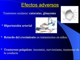Efectos adversos Trastornos oculares:  cataratas ,  glaucoma *  Hipertensión arterial *  Retardo del crecimiento  en tratamientos en niños. *  Trastornos psíquicos : insomnio, nerviosismo, trastornos de la conducta 