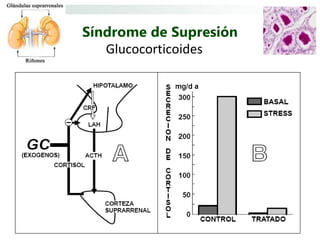 Síndrome de Supresión
   Glucocorticoides
 