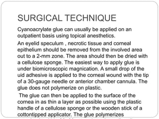 SURGICAL TECHNIQUE
Cyanoacrylate glue can usually be applied on an
outpatient basis using topical anesthetics.
An eyelid speculum , necrotic tissue and corneal
epithelium should be removed from the involved area
out to a 2-mm zone. The area should then be dried with
a cellulose sponge. The easiest way to apply glue is
under biomicroscopic magnication. A small drop of the
uid adhesive is applied to the corneal wound with the tip
of a 30-gauge needle or anterior chamber cannula. The
glue does not polymerize on plastic.
The glue can then be applied to the surface of the
cornea in as thin a layer as possible using the plastic
handle of a cellulose sponge or the wooden stick of a
cottontipped applicator. The glue polymerizes
 