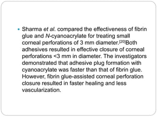  Sharma et al. compared the effectiveness of fibrin
glue and N-cyanoacrylate for treating small
corneal perforations of 3 mm diameter.[20]Both
adhesives resulted in effective closure of corneal
perforations <3 mm in diameter. The investigators
demonstrated that adhesive plug formation with
cyanoacrylate was faster than that of fibrin glue.
However, fibrin glue-assisted corneal perforation
closure resulted in faster healing and less
vascularization.
 