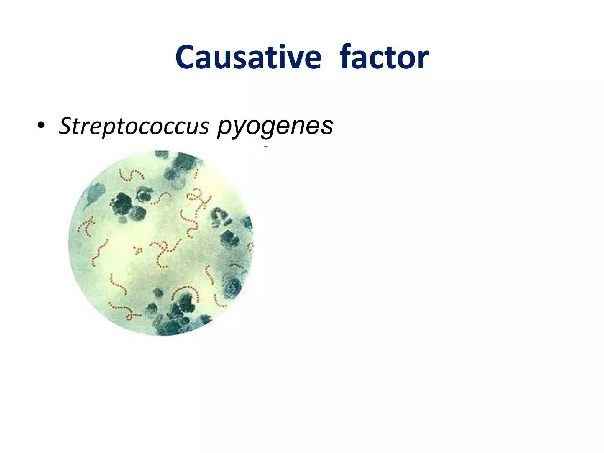 Causative factor
• Streptococcus pyogenes
 