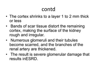 contd
• The cortex shrinks to a layer 1 to 2 mm thick
or less
• Bands of scar tissue distort the remaining
cortex, making the surface of the kidney
rough and irregular.
• Numerous glomeruli and their tubules
become scarred, and the branches of the
renal artery are thickened.
• The result is severe glomerular damage that
results inESRD.
 