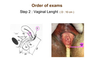 Order of exams Step 2 : Vaginal Lenght   ( D : 10 cm ) 
