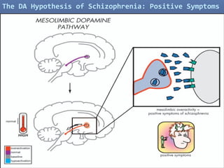 22
The DA Hypothesis of Schizophrenia: Positive Symptoms
 