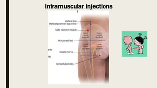 Intramuscular injections
 