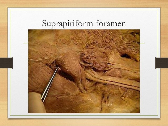 Gluteal region clinical anatomy