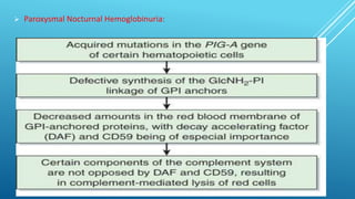  Paroxysmal Nocturnal Hemoglobinuria:
 