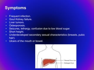 • Frequent infection.
• Gout Kidney failure.
• Liver tumors.
• Osteoporosis.
• Seizures, lethargy, confusion due to low blood sugar.
• Short height.
• Underdeveloped secondary sexual characteristics (breasts, pubic
hair).
• Ulcers of the mouth or bowel.
Symptoms
 
