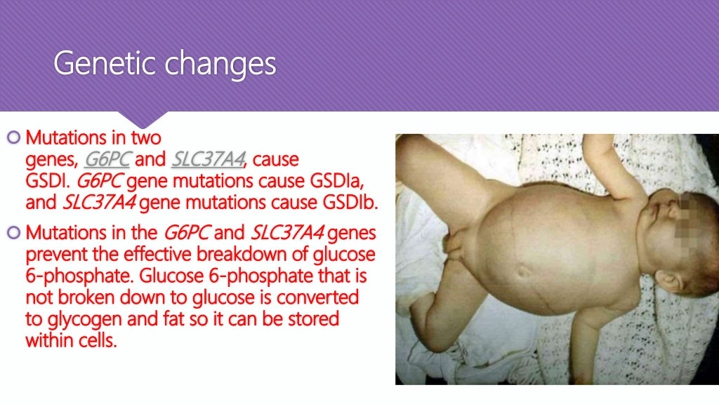 Glycogen storage disorders pathology