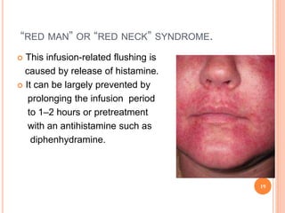 “RED MAN” OR “RED NECK” SYNDROME.
 This infusion-related flushing is
caused by release of histamine.
 It can be largely prevented by
prolonging the infusion period
to 1–2 hours or pretreatment
with an antihistamine such as
diphenhydramine.
19
 