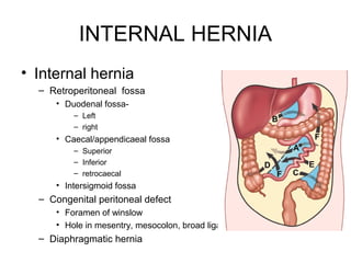 INTERNAL HERNIA
• Internal hernia
– Retroperitoneal fossa
• Duodenal fossa-
– Left
– right
• Caecal/appendicaeal fossa
– Superior
– Inferior
– retrocaecal
• Intersigmoid fossa
– Congenital peritoneal defect
• Foramen of winslow
• Hole in mesentry, mesocolon, broad ligament
– Diaphragmatic hernia
 