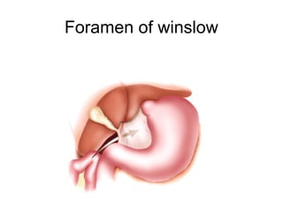 Foramen of winslow
 