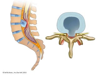 © Seif & Assoc., Inc./Sue Seif, 2013
 