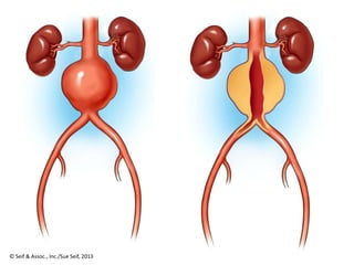 © Seif & Assoc., Inc./Sue Seif, 2013
 