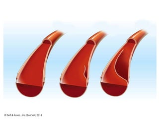 © Seif & Assoc., Inc./Sue Seif, 2013
 