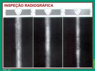 IFCE - 2017
Cícero
Moura
INSPEÇÃO RADIOGRÁFICA
 
