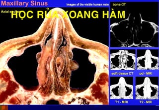 HOÏC RÖÛA XOANG HAØM
 