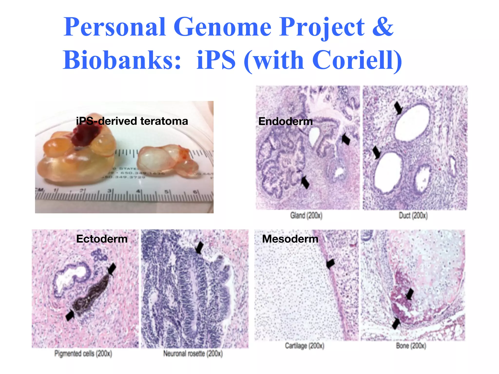 Personal Genome Project &
Biobanks: iPS (with Coriell)

 iPS-derived teratoma
   Endoderm




 Ectoderm
               Mesoderm
 